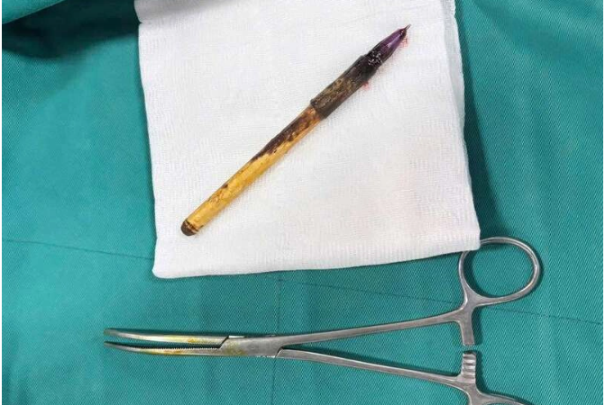 Quá bức xúc vụ học sinh lớp 6 bị nhét bút vào hậu môn: Không thể chấp nhận được luôn