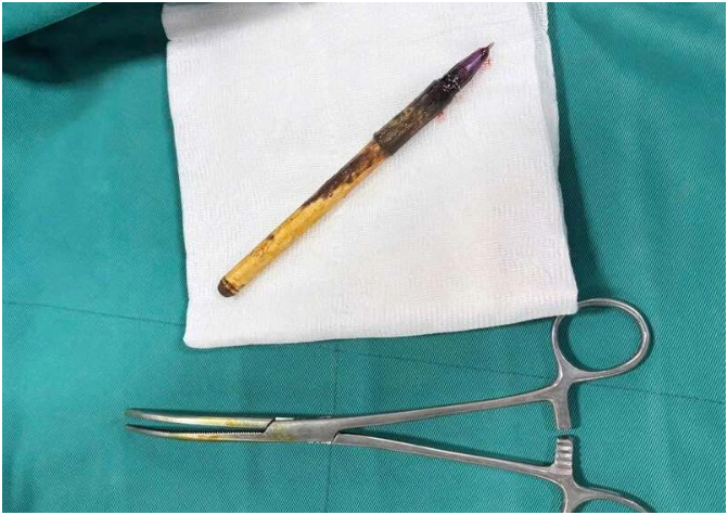 Quá bức xúc vụ học sinh lớp 6 bị nhét bút vào hậu môn: Không thể chấp nhận được luôn
