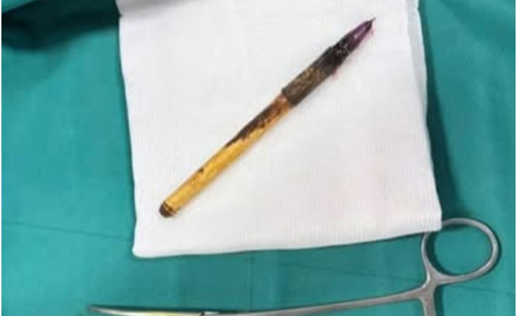 CA vào cuộc vụ bé trai lớp 6 ở Hà Nội nghi bị nhét bút vào hậu môn: Thôi xong thật rồi