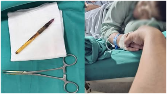 Rõ động thái của giáo viên chủ nhiệm vụ bé trai lớp 6 bị nhét bút vào hậu môn: Không ngờ luôn đấy