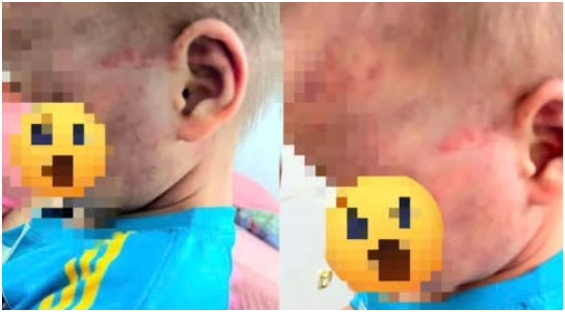 Cha dượng khai gì sau vụ bé trai 3 tuổi ở Gia Lai bị bạo hành phải nhập viện?