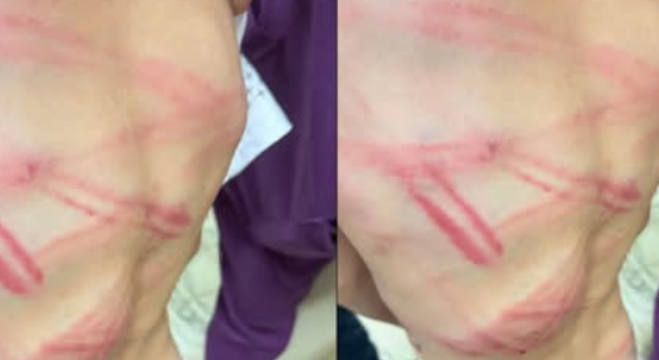 Lời khai của người cha trong vụ bé trai 9 tuổi nhập viện nghi bị bạo hành: Càng nghe càng gây bức xúc