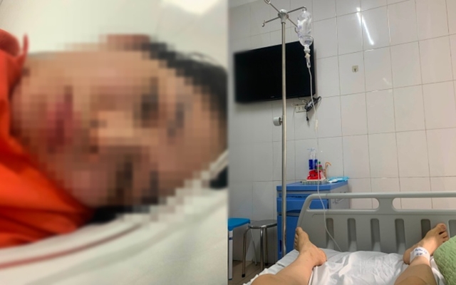 Vụ sản phụ tố bị liệt hai chân sau mổ lấy thai: Bệnh viện lên tiếng, cho rằng đây là tai biến y khoa không mong muốn