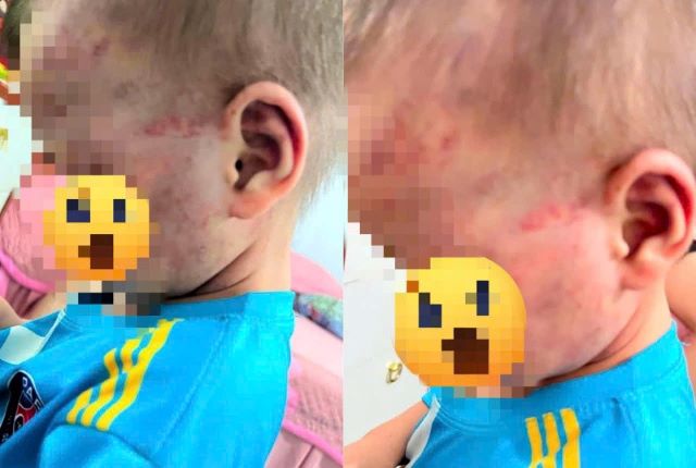 Cha dượng bạo hành con riêng của vợ: Cộng đồng mạng phẫn nộ vì quá tàn nhẫn