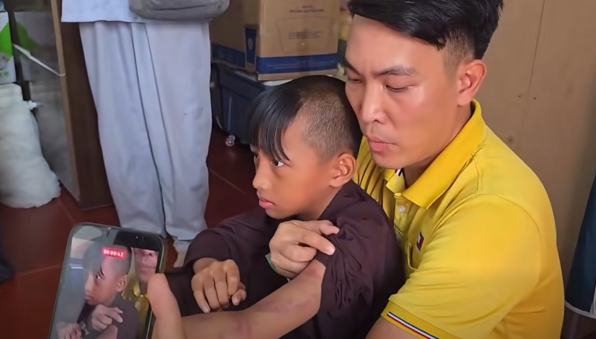 Vụ 5 chú tiểu bị đánh ở chùa Bầu, Phú Thọ: Bộ Y Tế ra yêu cầu khẩn