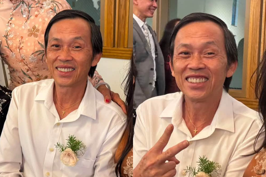 Hoài Linh khiến fan lo lắng vì diện mạo thay đổi: Em trai tiết lộ nguyên nhân, hóa ra là vì điều này